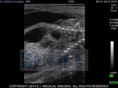 母牛怀孕90天的牛用B超图像分析