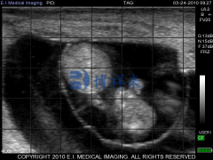 <b>进口牛用B超检测母牛妊娠45天B超图像</b>