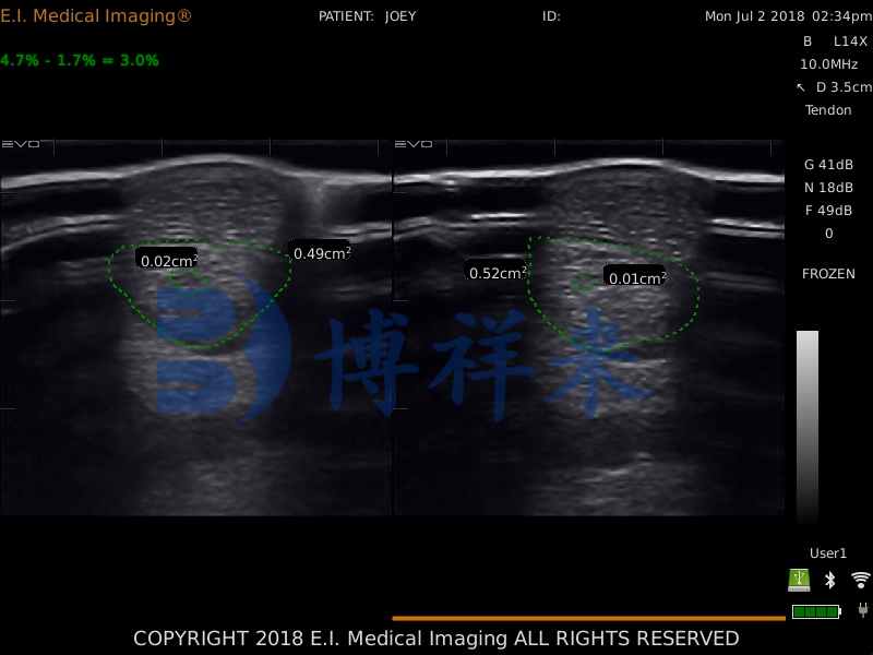 进口兽用B超检测马肌腱韧带恢复情况
