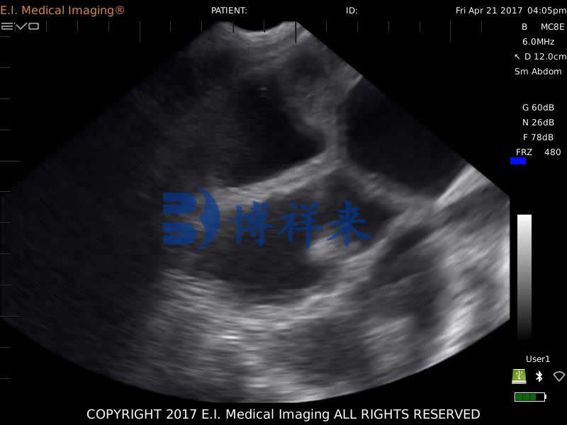 母猪怀孕25天B超图像