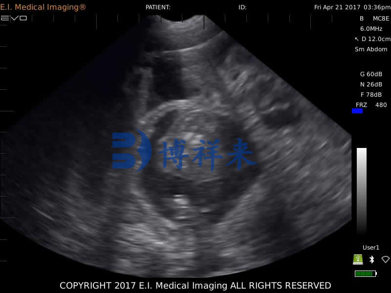 母猪怀孕60多天B超图像特点