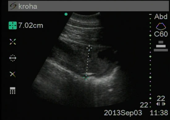 兽用B超机检测海豚怀孕2个月超声图像