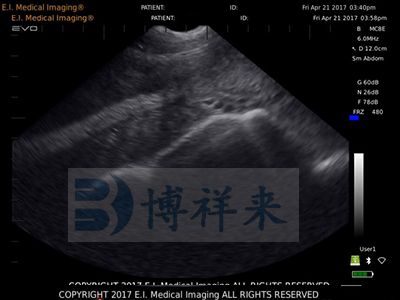 母猪空怀B超机图像