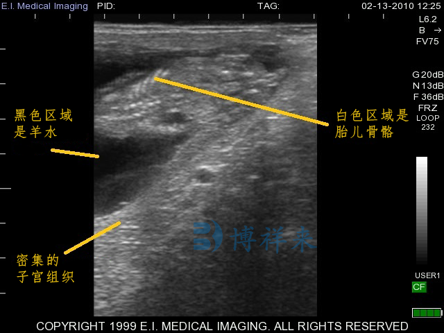 兽用B超图像判断公母——小母牛