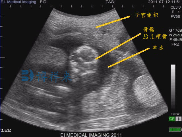 羊妊娠63天兽用B超图像特点