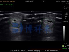 进口兽用B超检测马肌腱韧带愈合情况