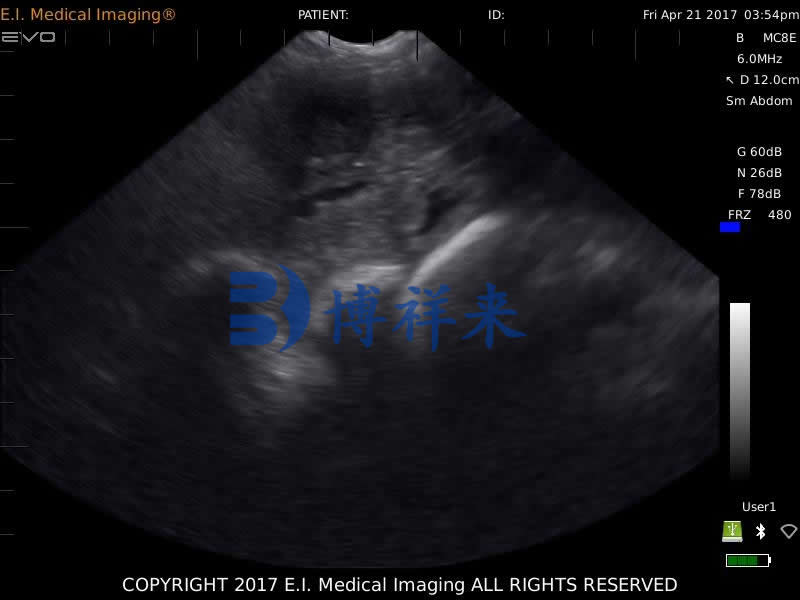 母猪怀孕19天B超图像