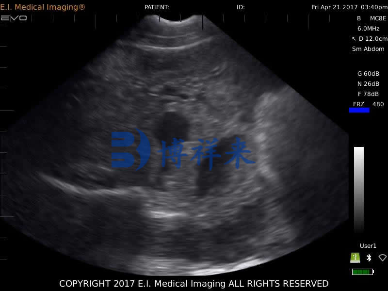 母猪怀孕40多天B超图像