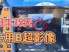 牛用B超检测母牛怀孕35天B超图像