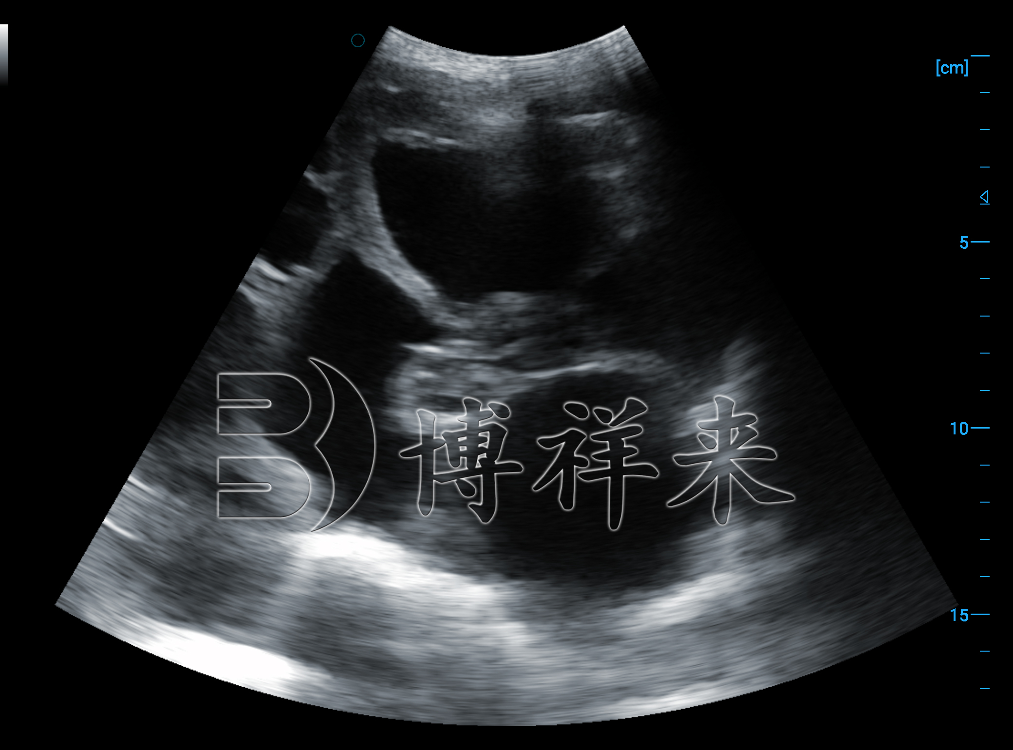 猪怀孕30天B超影像图 猪怀孕30天B超影像图