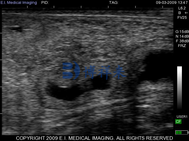 牛怀孕25天超声图像