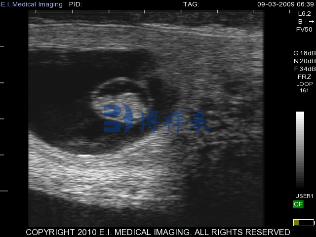 母牛怀孕30天B超图像