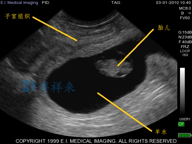 兽用B超机检测母牛妊娠超声图像