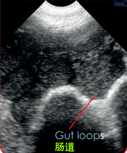 空怀母猪超声图像