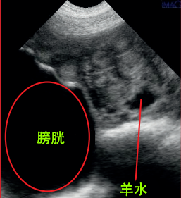 母猪妊娠超声图