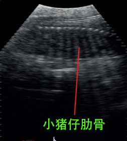 母猪妊娠100天超声图像