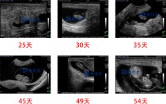 兽用B超测母牛妊娠如何通过超声图片判断