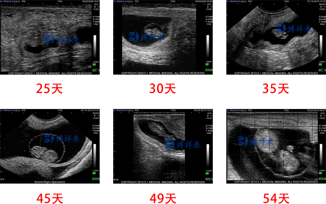 兽用B超测孕仪超声检测图片